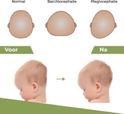 Novalits - Orthopedisch Baby Zijslaapkussen Met Traagschuim En Anti-Allergene Bamboe Microvezel Stof Om Een Plat Hoofd Tegen Te Gaan - Zijligkussen Voor Peuter - Babykussen Zijligging - Rolkussen - Steunkussen - Slaapondersteuning 7 Novalits - Orthopedisch Baby Zijslaapkussen Met Traagschuim En Anti-Allergene Bamboe Microvezel Stof Om Een Plat Hoofd Tegen Te Gaan - Zijligkussen Voor Peuter - Babykussen Zijligging - Rolkussen - Steunkussen - Slaapondersteuning -Winkel voor babyproducten 1200x1103 9