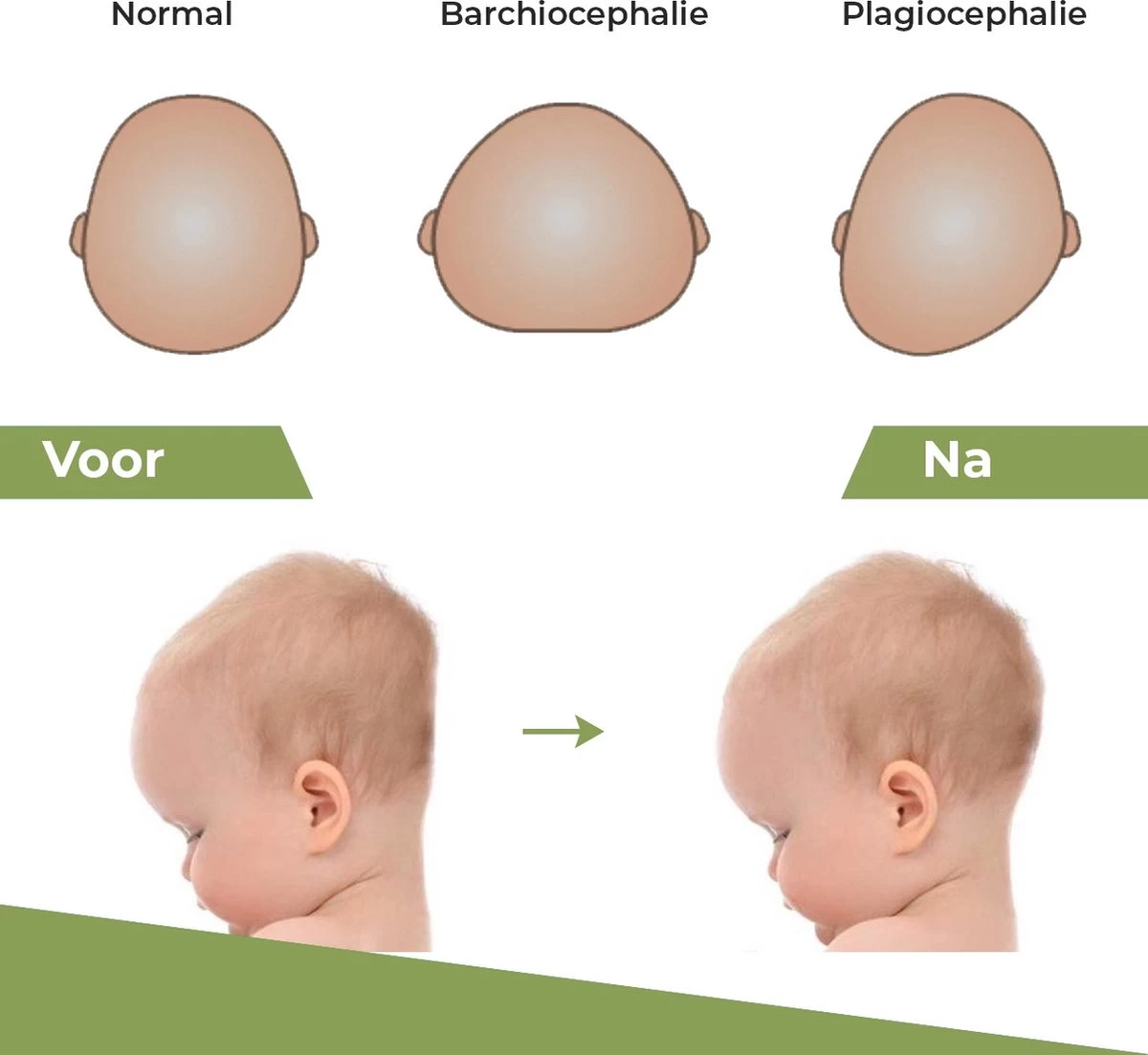 Novalits - Orthopedisch Baby Zijslaapkussen met Traagschuim en Anti-Allergene Bamboe Microvezel Stof om een plat hoofd tegen te gaan - Zijligkussen voor Peuter - Babykussen zijligging - Rolkussen - Steunkussen - Slaapondersteuning Novalits - Orthopedisch Baby Zijslaapkussen Met Traagschuim En Anti-Allergene Bamboe Microvezel Stof Om Een Plat Hoofd Tegen Te Gaan - Zijligkussen Voor Peuter - Babykussen Zijligging - Rolkussen - Steunkussen - Slaapondersteuning -Winkel voor babyproducten 1200x1103 9